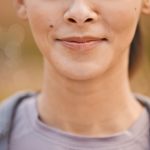 Close up of a young females face who is showing signs of bulimia face