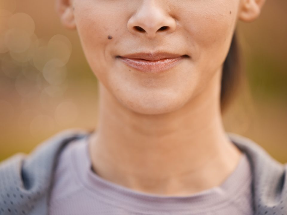 Close up of a young females face who is showing signs of bulimia face